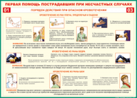 Таблица "Порядок действий при опасном кровотечении" (100х140 сантиметров, винил) - fgospostavki.ru - Саратов