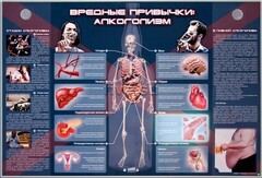 Электрифицированный стенд "Вредные привычки: алкоголизм" - fgospostavki.ru - Саратов